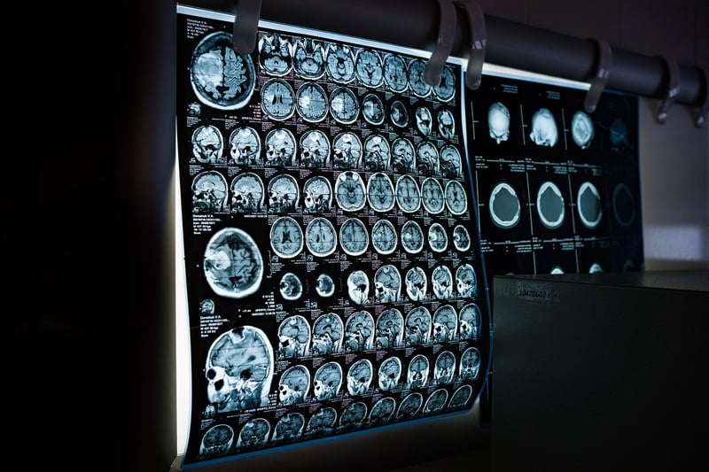 Neural Implants